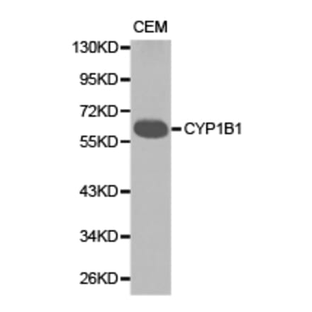 Anti-CYP1B1 Antibody from Bioworld Technology (BS6576) - Antibodies.com