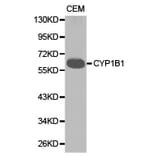 Anti-CYP1B1 Antibody from Bioworld Technology (BS6576) - Antibodies.com