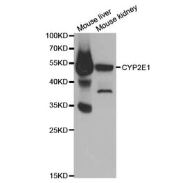 Anti-CYP2E1 Antibody from Bioworld Technology (BS6577) - Antibodies.com