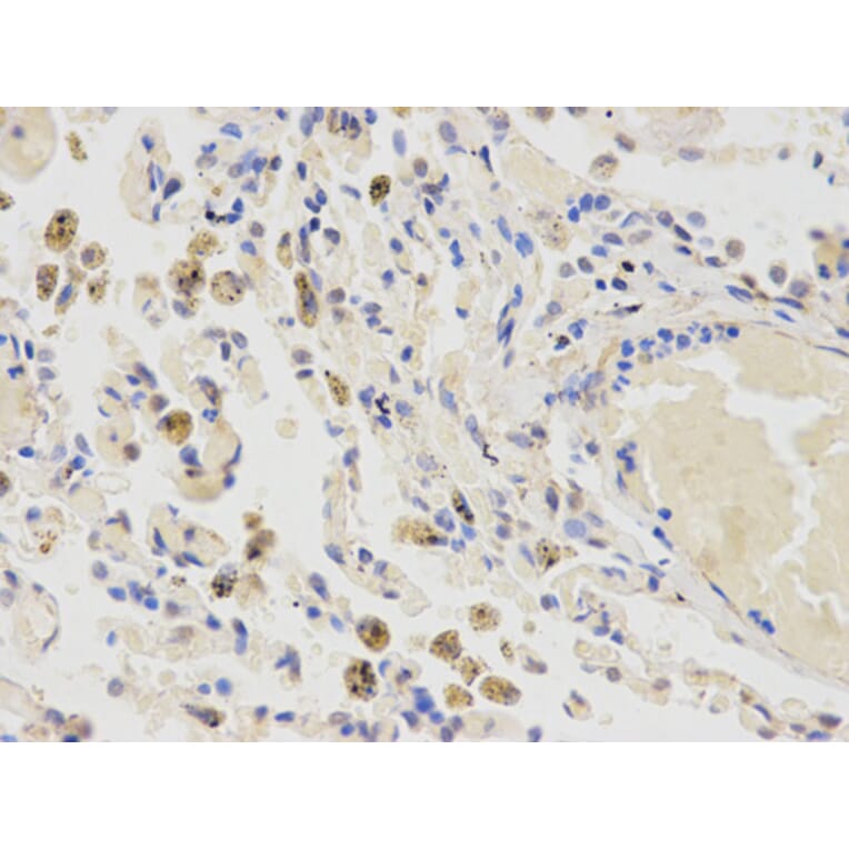 Anti-CYP2E1 Antibody from Bioworld Technology (BS6577) - Antibodies.com