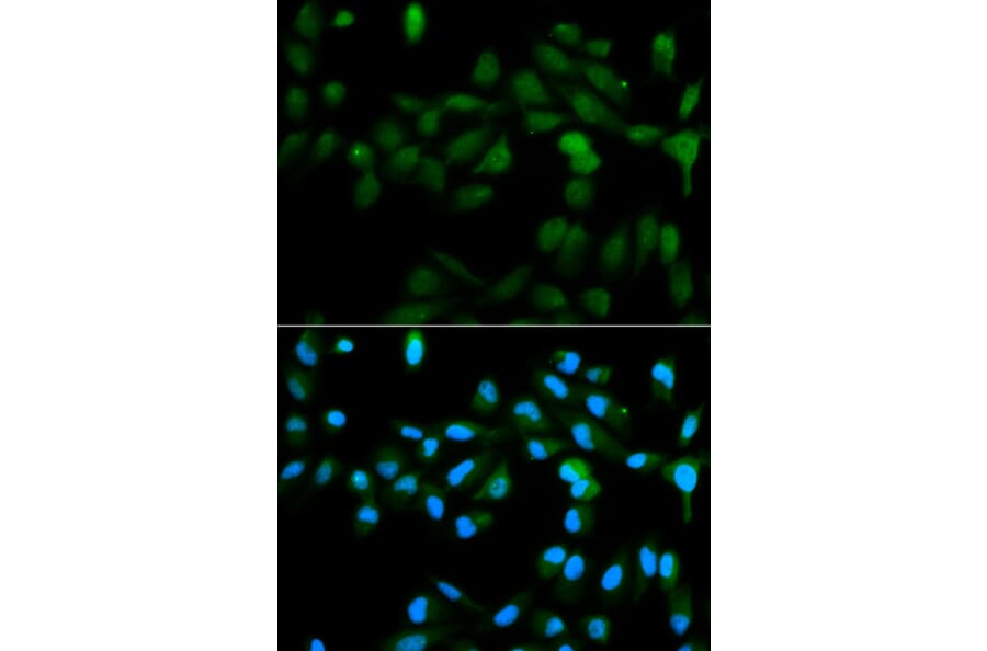 Anti-CYP11A1 Antibody from Bioworld Technology (BS6578) - Antibodies.com