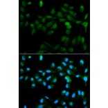 Anti-CYP11A1 Antibody from Bioworld Technology (BS6578) - Antibodies.com