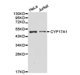 Anti-CYP17A1 Antibody from Bioworld Technology (BS6579) - Antibodies.com