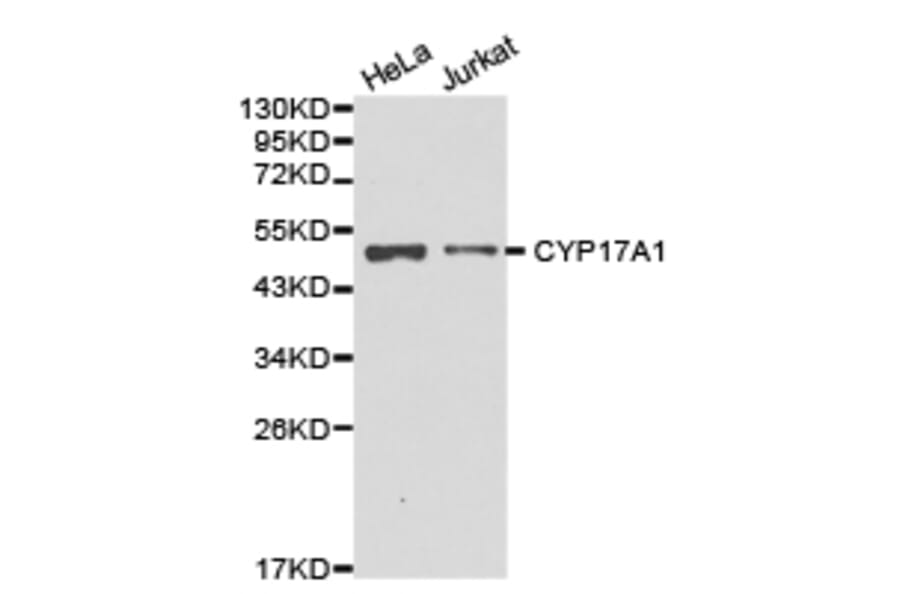 Anti-CYP17A1 Antibody from Bioworld Technology (BS6579) - Antibodies.com