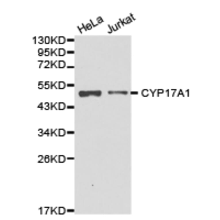 Anti-CYP17A1 Antibody from Bioworld Technology (BS6579) - Antibodies.com