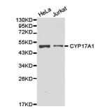 Anti-CYP17A1 Antibody from Bioworld Technology (BS6579) - Antibodies.com