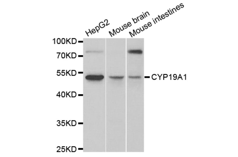 Anti-CYP19A1 Antibody from Bioworld Technology (BS6580) - Antibodies.com