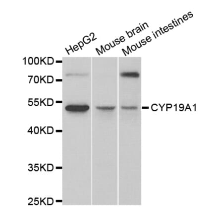Anti-CYP19A1 Antibody from Bioworld Technology (BS6580) - Antibodies.com