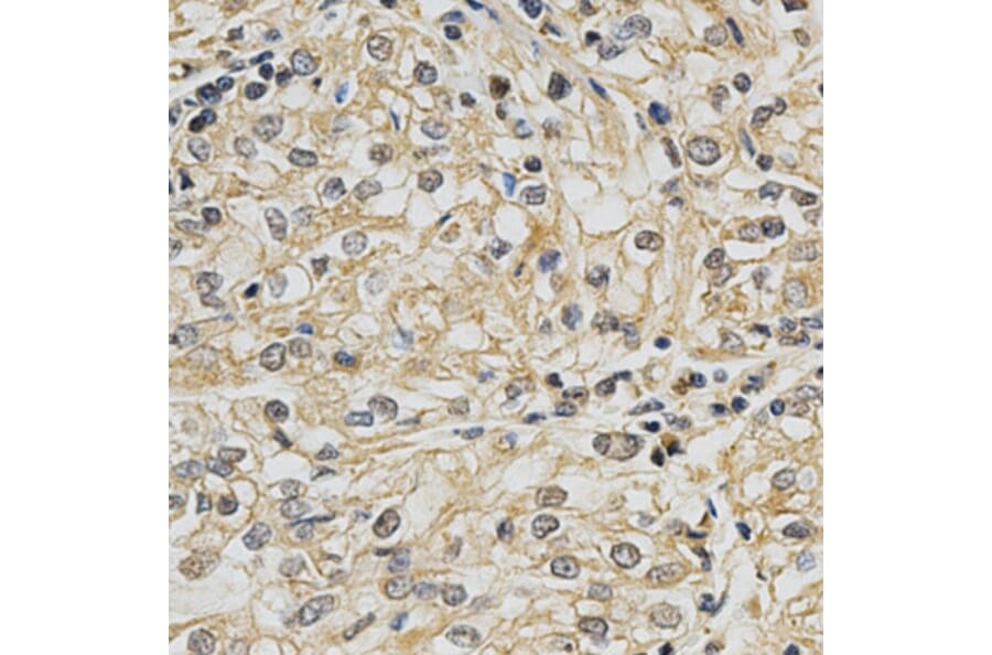 Anti-CYP19A1 Antibody from Bioworld Technology (BS6580) - Antibodies.com