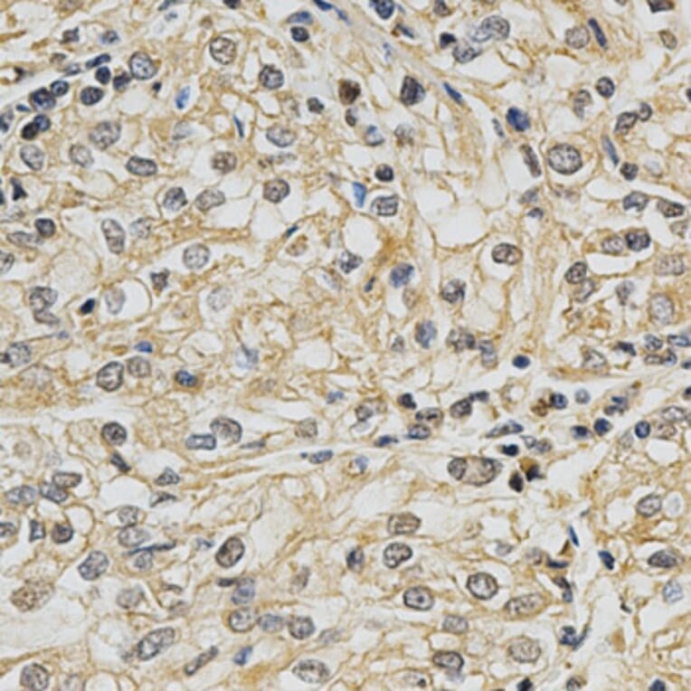 Anti-CYP19A1 Antibody from Bioworld Technology (BS6580) - Antibodies.com