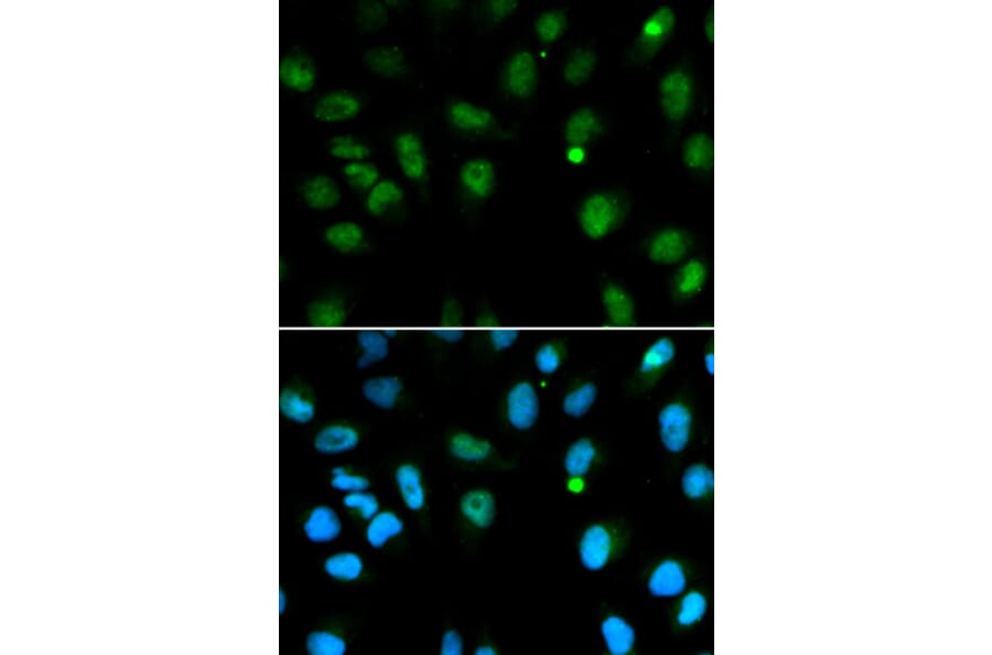 Anti-DCK Antibody from Bioworld Technology (BS6581) - Antibodies.com