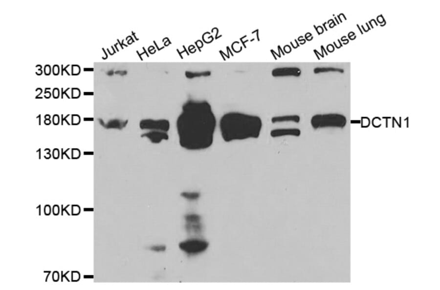 Anti-DCTN1 Antibody from Bioworld Technology (BS6583) - Antibodies.com