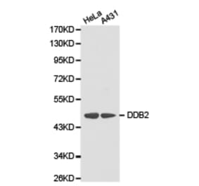 Anti-DDB2 Antibody from Bioworld Technology (BS6584) - Antibodies.com