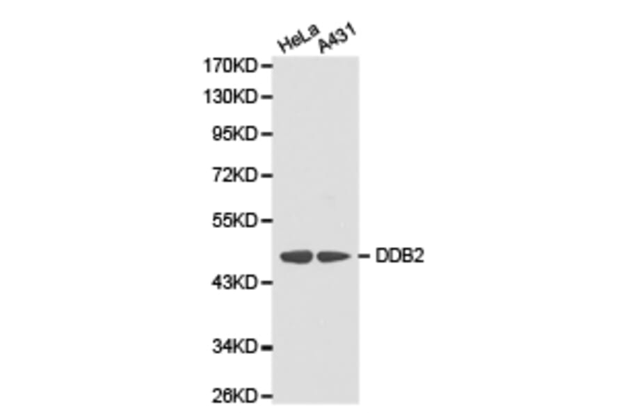 Anti-DDB2 Antibody from Bioworld Technology (BS6584) - Antibodies.com