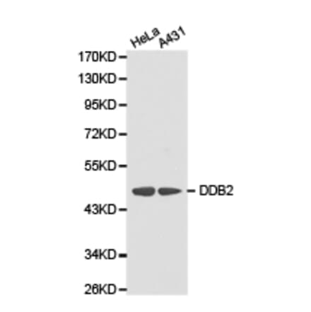 Anti-DDB2 Antibody from Bioworld Technology (BS6584) - Antibodies.com