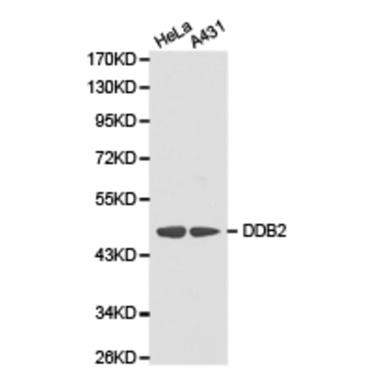 Anti-DDB2 Antibody from Bioworld Technology (BS6584) - Antibodies.com
