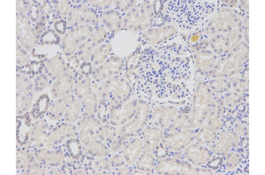 Anti-DDB2 Antibody from Bioworld Technology (BS6584) - Antibodies.com