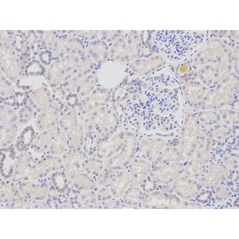 Anti-DDB2 Antibody from Bioworld Technology (BS6584) - Antibodies.com