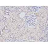 Anti-DDB2 Antibody from Bioworld Technology (BS6584) - Antibodies.com