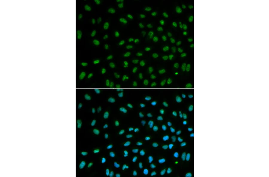 Anti-DDB2 Antibody from Bioworld Technology (BS6584) - Antibodies.com