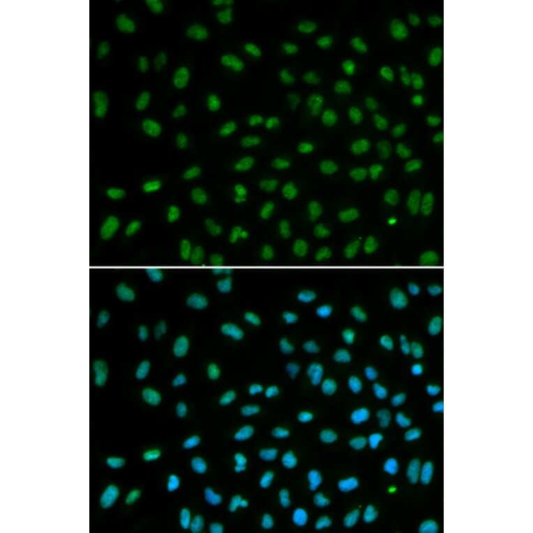 Anti-DDB2 Antibody from Bioworld Technology (BS6584) - Antibodies.com