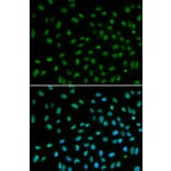 Anti-DDB2 Antibody from Bioworld Technology (BS6584) - Antibodies.com