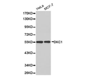 Anti-Dyskerin Antibody from Bioworld Technology (BS6586) - Antibodies.com