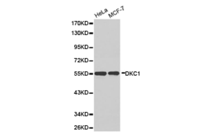 Anti-Dyskerin Antibody from Bioworld Technology (BS6586) - Antibodies.com
