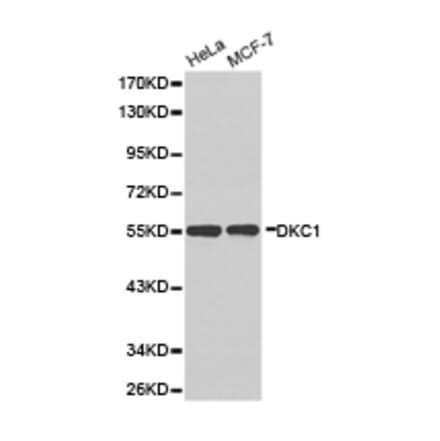 Anti-Dyskerin Antibody from Bioworld Technology (BS6586) - Antibodies.com