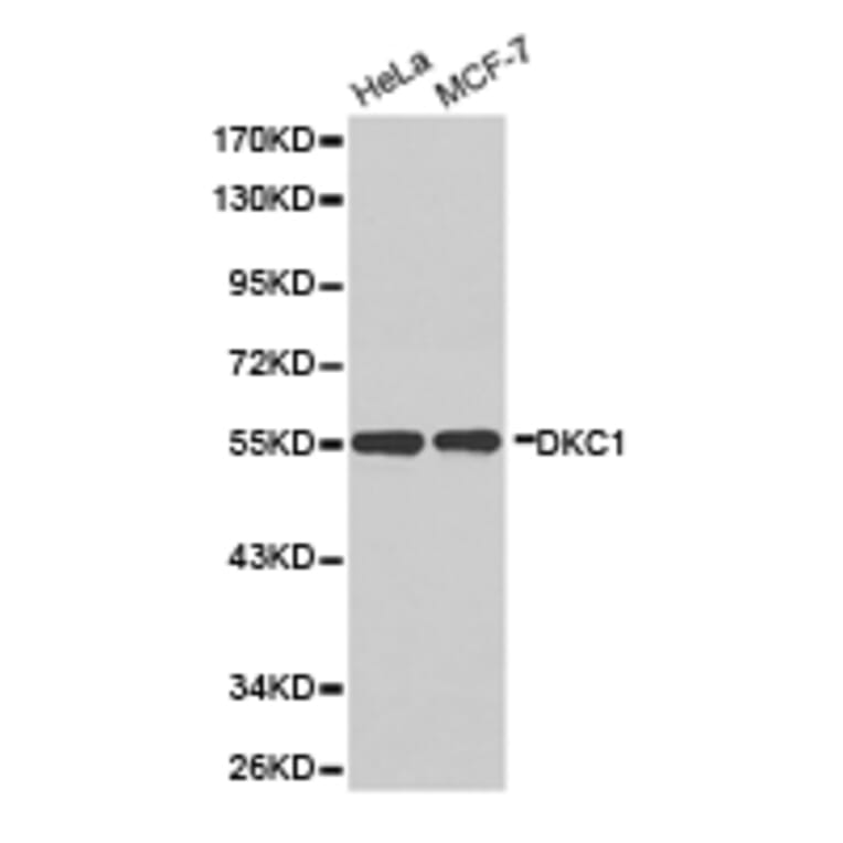 Anti-Dyskerin Antibody from Bioworld Technology (BS6586) - Antibodies.com