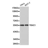 Anti-Dyskerin Antibody from Bioworld Technology (BS6586) - Antibodies.com