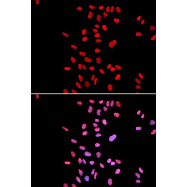 Anti-Dyskerin Antibody from Bioworld Technology (BS6586) - Antibodies.com