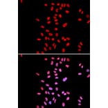 Anti-Dyskerin Antibody from Bioworld Technology (BS6586) - Antibodies.com