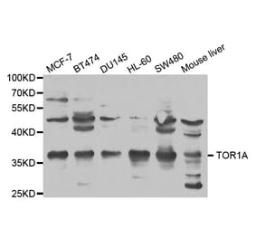 Anti-TOR1A Antibody from Bioworld Technology (BS6589) - Antibodies.com