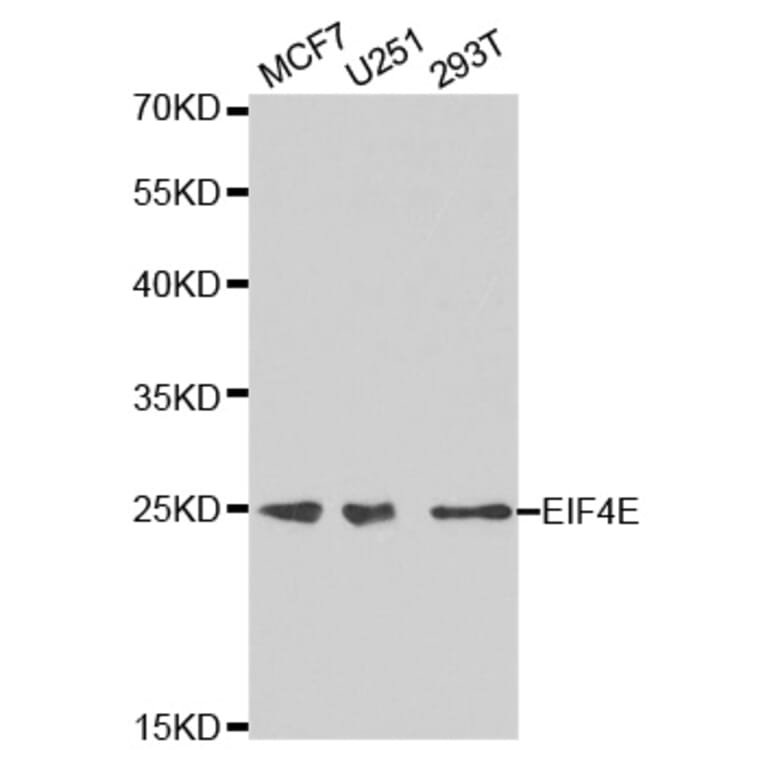 Anti-eIF4E Antibody from Bioworld Technology (BS6591) - Antibodies.com
