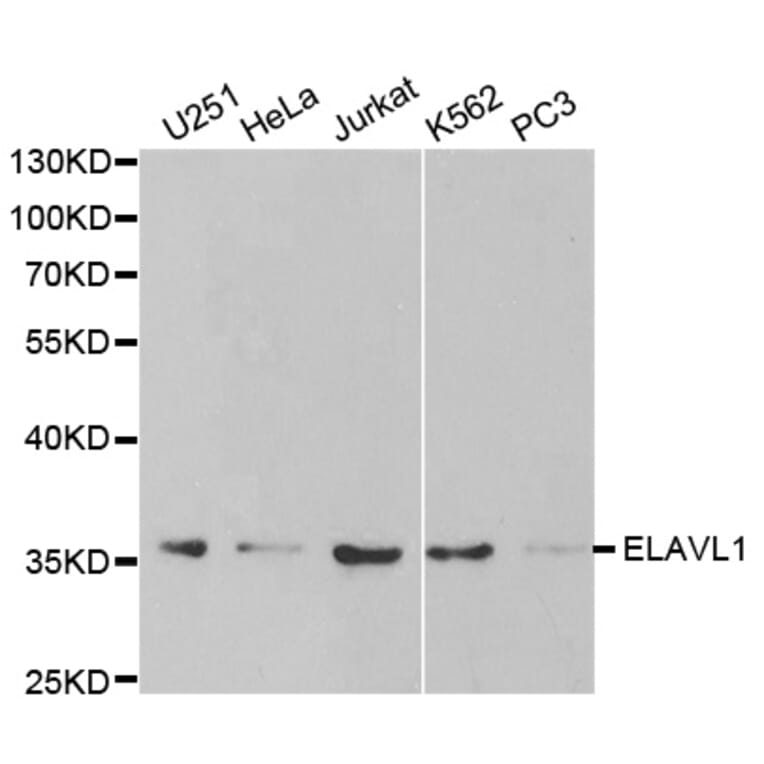 Anti-ELAVL1 Antibody from Bioworld Technology (BS6592) - Antibodies.com