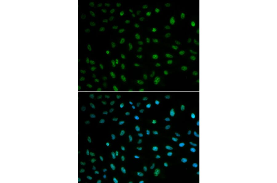 Anti-ELAVL1 Antibody from Bioworld Technology (BS6592) - Antibodies.com
