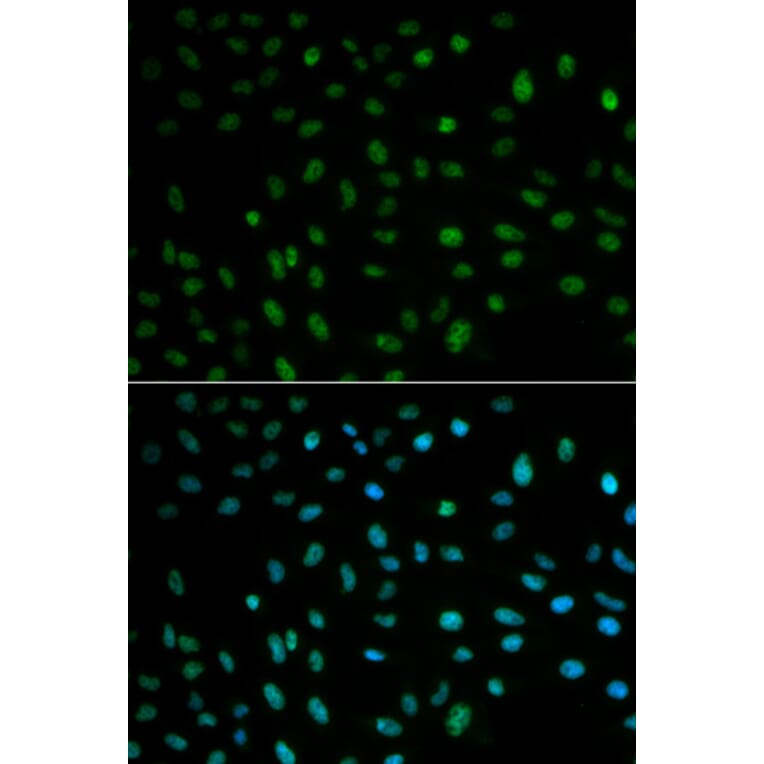 Anti-ELAVL1 Antibody from Bioworld Technology (BS6592) - Antibodies.com