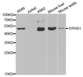 Anti-EPHX1 Antibody from Bioworld Technology (BS6593) - Antibodies.com