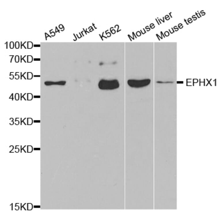 Anti-EPHX1 Antibody from Bioworld Technology (BS6593) - Antibodies.com