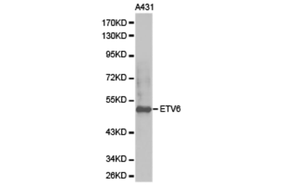 Anti-TEL/ETV6 Antibody from Bioworld Technology (BS6596) - Antibodies.com