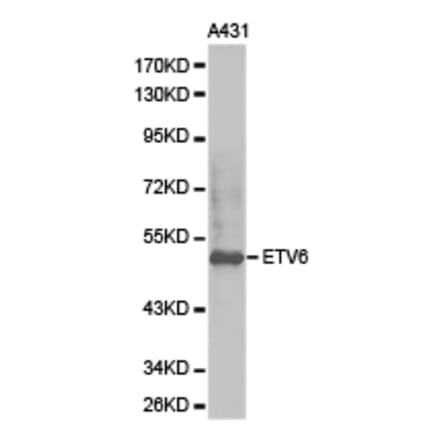 Anti-TEL/ETV6 Antibody from Bioworld Technology (BS6596) - Antibodies.com