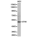 Anti-TEL/ETV6 Antibody from Bioworld Technology (BS6596) - Antibodies.com