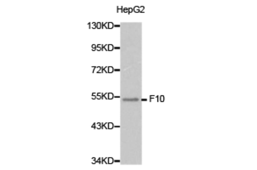 Anti-F10 Antibody from Bioworld Technology (BS6600) - Antibodies.com