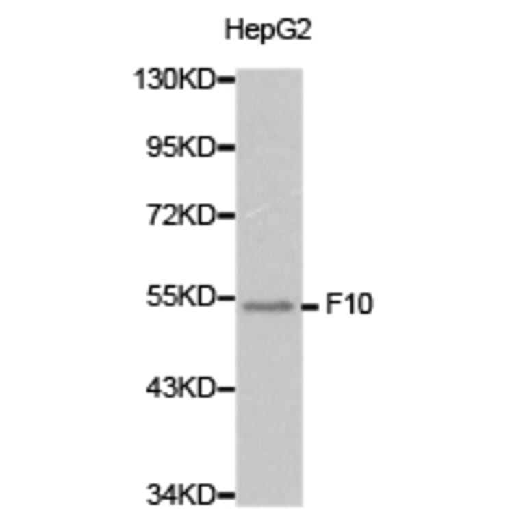Anti-F10 Antibody from Bioworld Technology (BS6600) - Antibodies.com