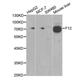 Anti-F12 Antibody from Bioworld Technology (BS6601) - Antibodies.com