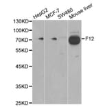 Anti-F12 Antibody from Bioworld Technology (BS6601) - Antibodies.com