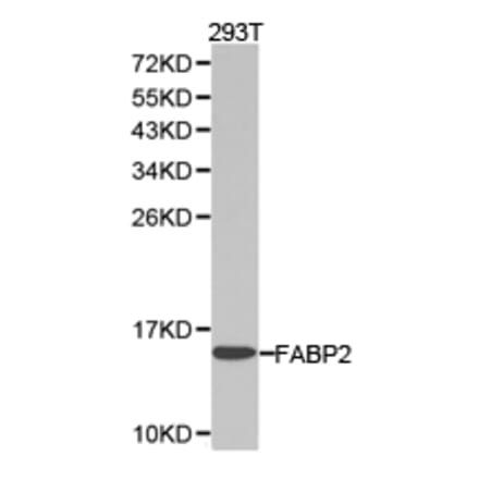 Anti-FABP2 Antibody from Bioworld Technology (BS6602) - Antibodies.com