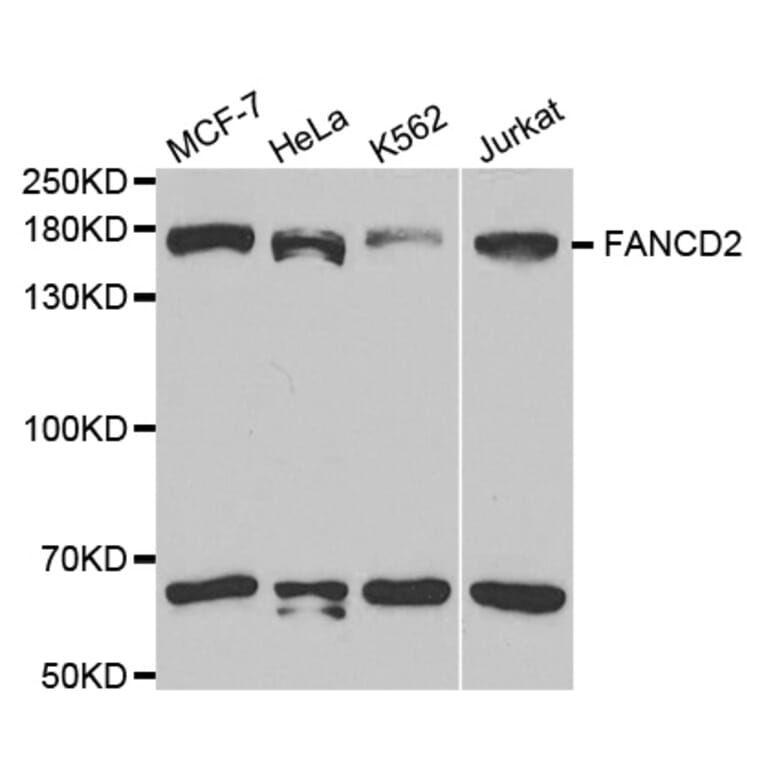 Anti-FANCD2 Antibody from Bioworld Technology (BS6604) - Antibodies.com