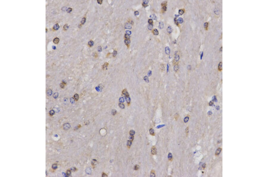 Anti-FANCD2 Antibody from Bioworld Technology (BS6604) - Antibodies.com